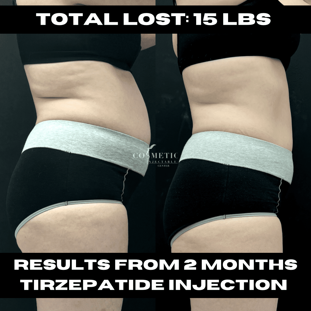 tirzepatide injection burbank Tirzepatide (Mounjaro) In Sherman Oaks