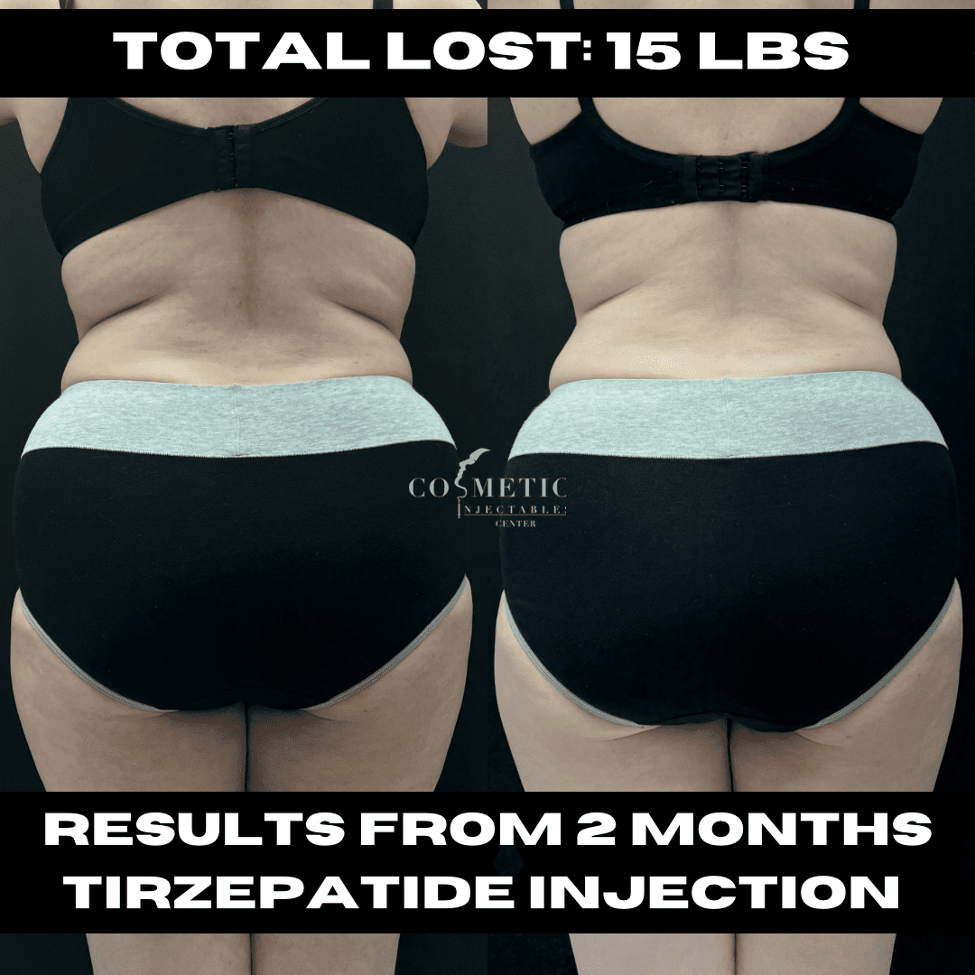 tirzepatide for cutting Mounjaro Medical Weight Loss Near Me in Fayetteville, NC Can Tirzepatide Help You Lose