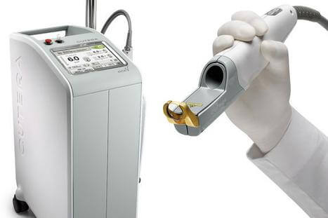 Laser 4 Cutera Excel V Laser Treatment Sherman Oaks